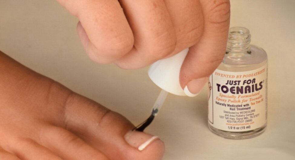 fungus nail polish on the big toe