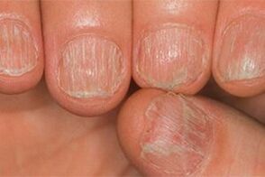 The lesion of the mushroom
