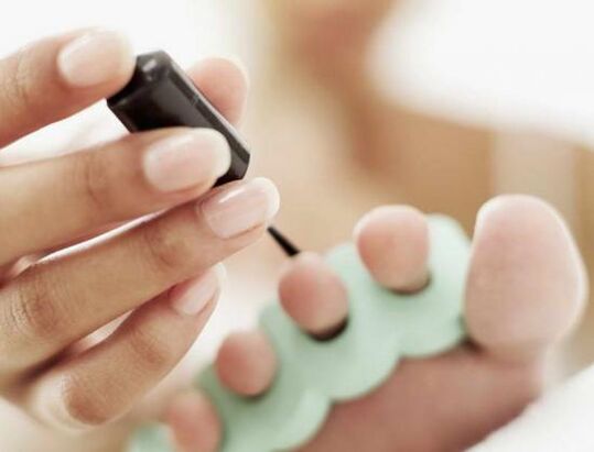 treat nails with nail polish for a fungal infection