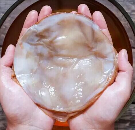 kombucha nail fungus