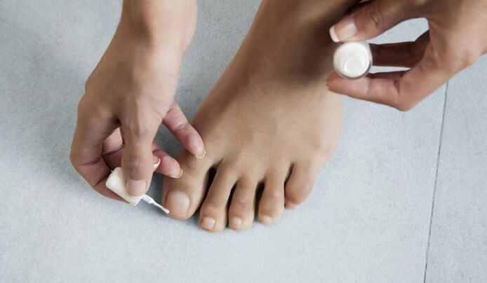 treatment of the fungus on the big toe with varnish